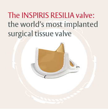 The INSPIRIS RESILIA valve: the world's most implanted surgical tissue valve<br> <br> <br>