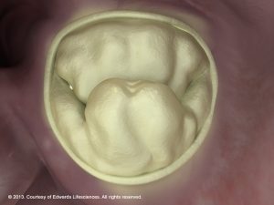 Image converted using ifftoany